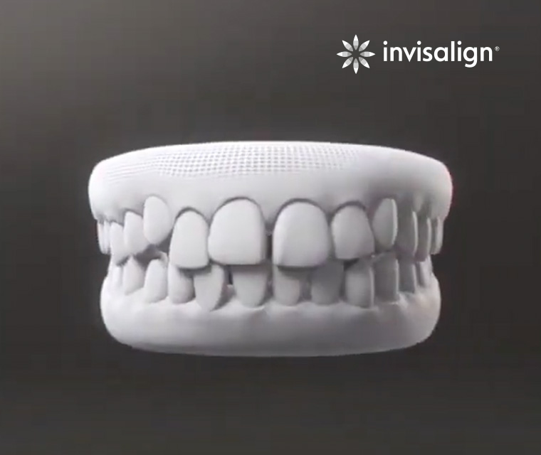 Get straighter teeth